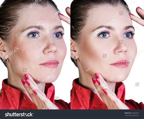 Woman Before After Cosmetic Procedure Stock Photo 520092877 | Shutterstock