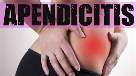 CUIDADO!! Descubra los que es el APENDICITIS y sus primeros SINTOMAS ...