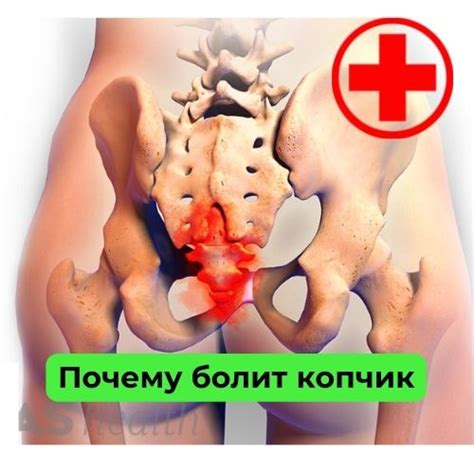 Почему болит копчик при сидении у женщин: причины боли в копчике