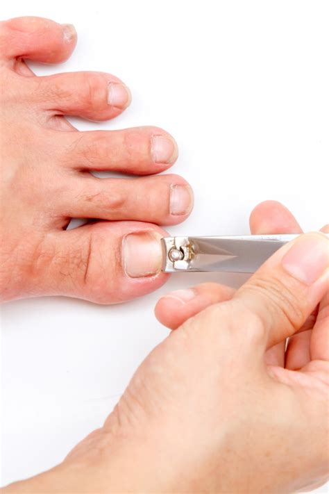 runners toe   ways  prevent  run  caroline