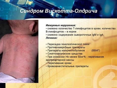 Иммунодефициты. Определение иммунодефицита - презентация онлайн