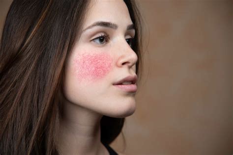 The most common skin conditions, and their cures