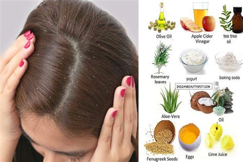 Feeling embarrassed because of dandruff! Check out these remedies - The ...
