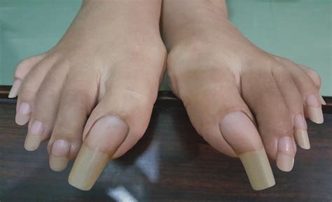 Crusty Toenails