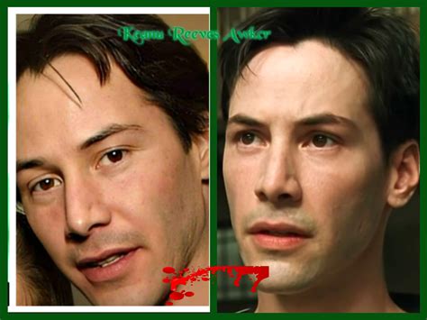 7 Unbelievable Keanu Reeves Plastic Surgery Secrets You NEED To See! Image 8