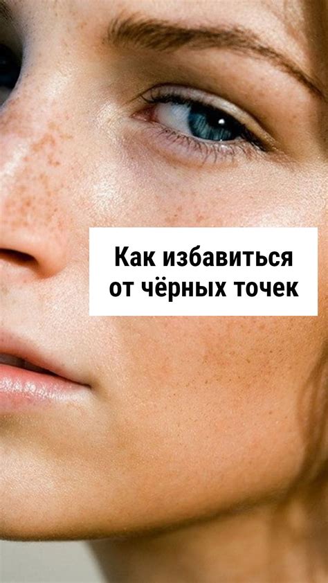 Как избавиться от чёрных точек | Beauty advice, Beauty hacks, Beauty ...