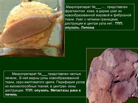 Макропрепараты к экзамену по патанатомии - презентация онлайн