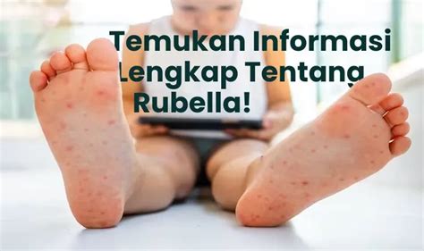 rubella penyebab gejala pengobatan  pencegahan  blog