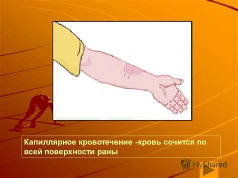 Презентация на тему: "Первая медицинская помощь при кровотечениях ...