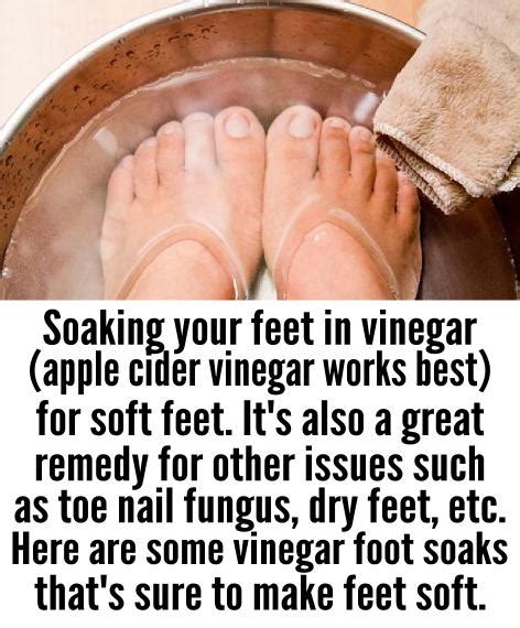 Apple Cider Vinegar for Soft Feet | DIY Beauty.Tips