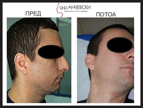 Акни – Дерматолошко естетска ординација – Др. Анчевски