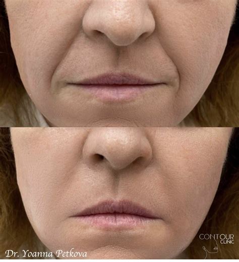 Естетични процедури за лице и тяло – 47 тема | Козметични и естетични ...