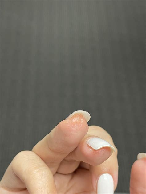 Help! Allergic to gel powder/polish. Any alternatives? : r/Nails