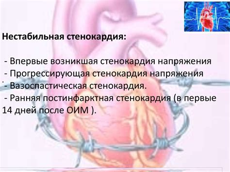 Стенокардия - презентация онлайн