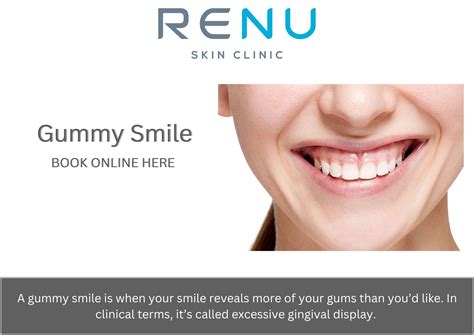 Gummy Smile | Renu Skin Clinic