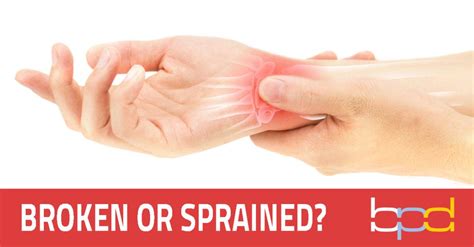 how to know if your arm is broken or sprained