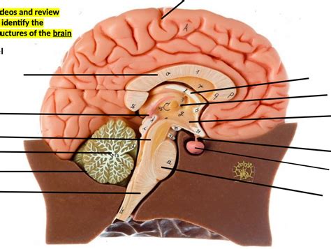 Infundibulum Brain