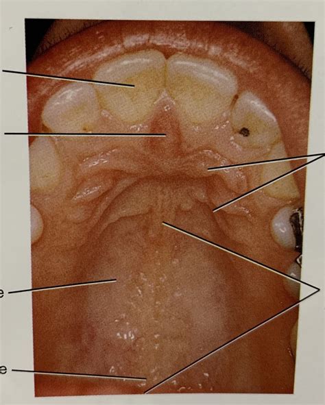 palate  mouth diagram quizlet
