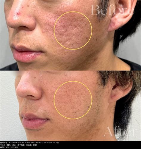 select clinic tips