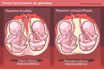 Vida de Mãe de Gêmeos: Univitelinos ou Bivitelinos