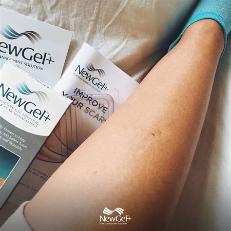 Sebbin Ecuador - Las cicatrices en los brazos y las...