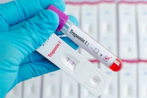 Тропониновый тест: норма, показания, подготовка, расшифровка