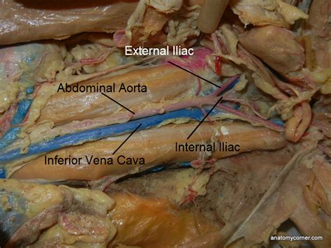 abdominalaortal