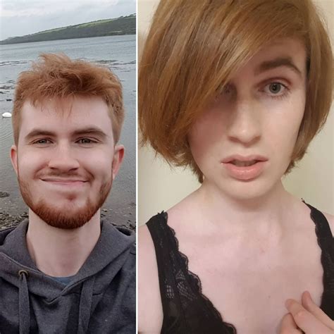 Albums 105+ Pictures Mtf Hrt Before And After Pictures Updated