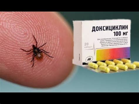 Что делать, если укусил боррелиозный клещ? #клещ #клещборрелиозный # ...