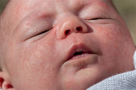 Bebe Com Bochecha Vermelha - Foto de Retrato Do Rosto De Um Bebê Recémnascido Com Bochechas ...