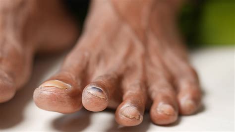 Close up of mature feet and toes 14143771 Stock Video at Vecteezy