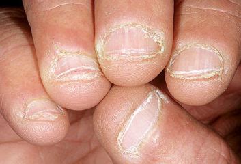 What Your Nails Say About Your Health » Ghana Gong