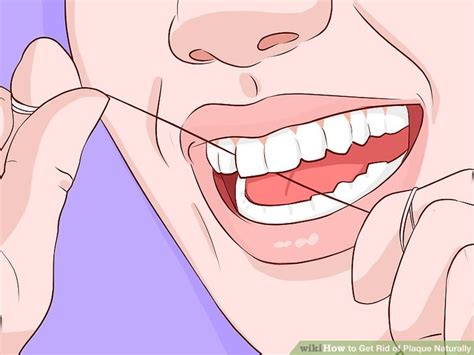 how to get rid of dental plaque at home