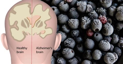 Bilberry: 7 Health Benefits - David Avocado Wolfe