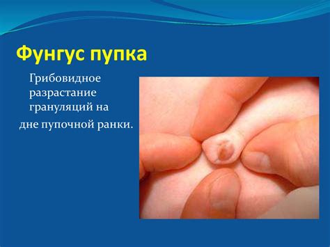 Неинфекционные и инфекционные гнойно-септические заболевания кожи и ...
