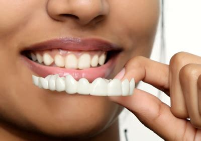 MR. SMILE съемные виниры