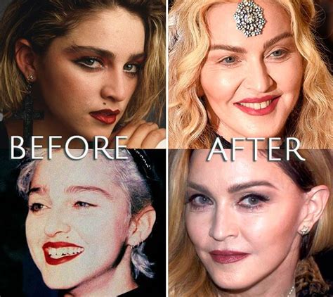 Madonna before and after – Artofit