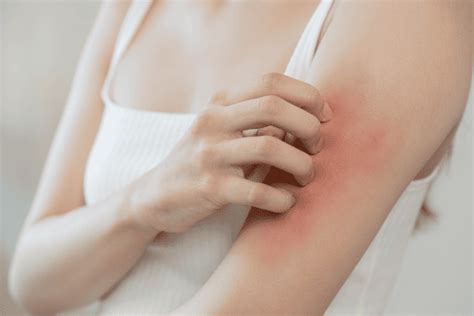 Penyakit MRSA - Simptom, Punca Dan Rawatan Yang Boleh Diambil