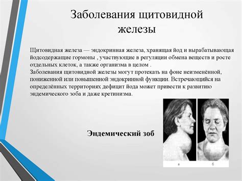 Гиподинамия, гипердинамия - презентация онлайн
