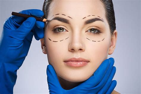 Eyelid (drooping eyelid) surgery - Veni Vidi Eye