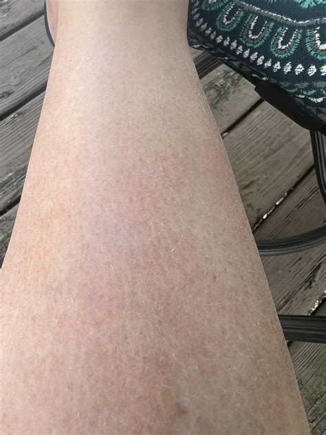 Any suggestions for this? My calves always look terrible. : r