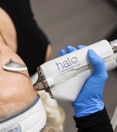 HALO Laser | Skin Resurfacing | BBL Forever Young