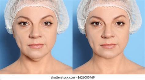 784 Blue dewlap Images, Stock Photos & Vectors | Shutterstock