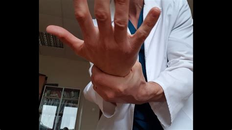 Карпальный туннельный синдром - сдавление срединного нерва. Доктор ...