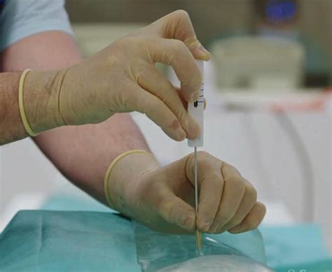 flexible surgical needle offers enhanced precision medical design briefs