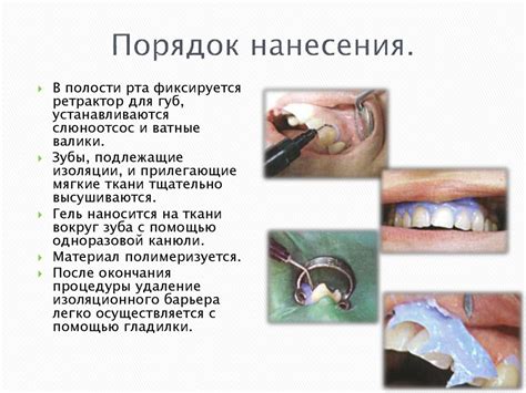 Методы изоляции и защиты рабочего поля - презентация онлайн