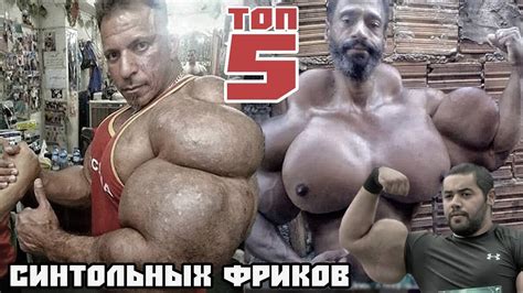 ТОП-5 СИНТОЛЬНЫХ ФРИКОВ - YouTube