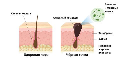 Как убрать черные точки в ушах? - Бізнес новини Одеси