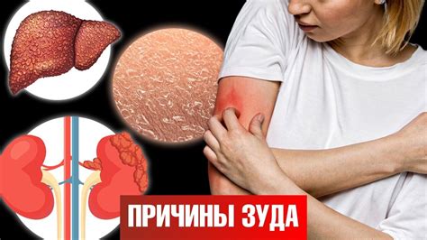 Сильный зуд? Много чешетесь? Вам не хватает клеток