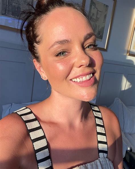 Sunken Eyes: Causes, Home Remedies & Effective Treatments